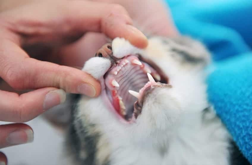 Teeth Examination